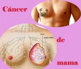 Día mundial de la lucha contra el Cáncer de Mama